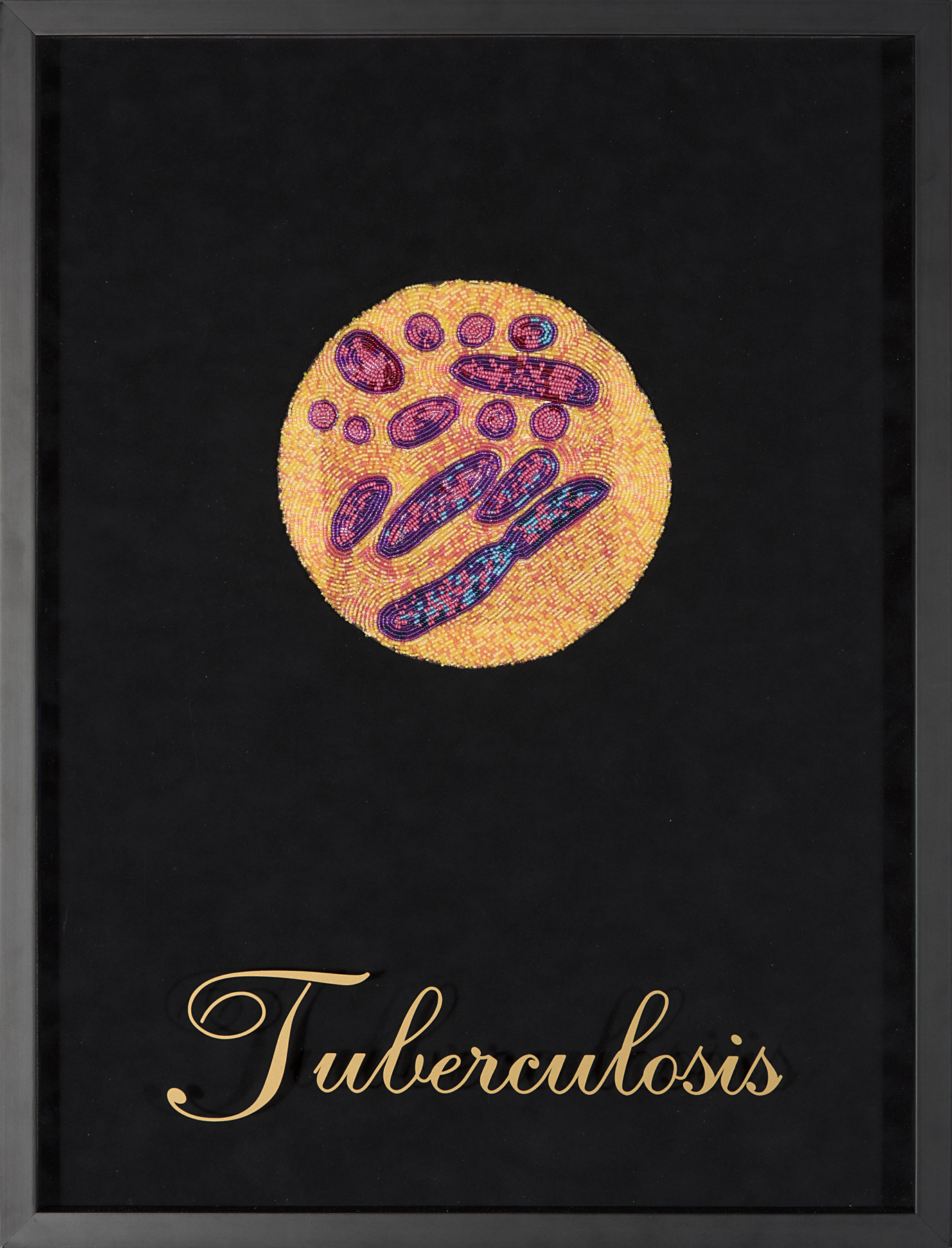 Reserving: Tuberculosis